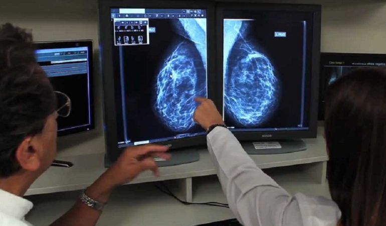 Denuncian que más de 4.000 mujeres de la Marina Alta no fueron citadas para la mamografía del programa de detección del cáncer de mama